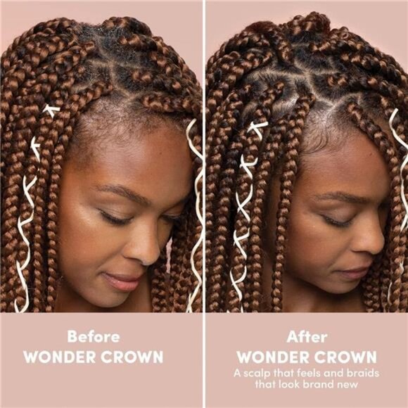 Wonder Crown Scalp Cleanser | Dry Scalp and Dandruff Treatment | Helps Stimulate - Picture 5 of 7